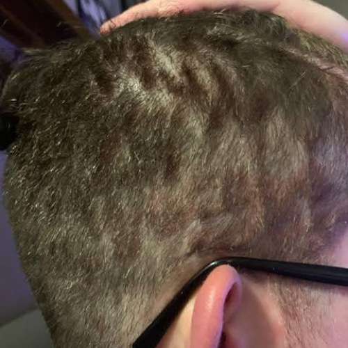 Patchy or Uneven Cut